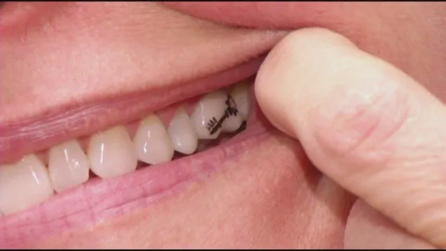 dental