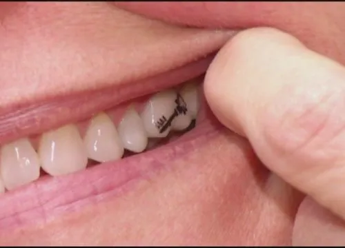 dental
